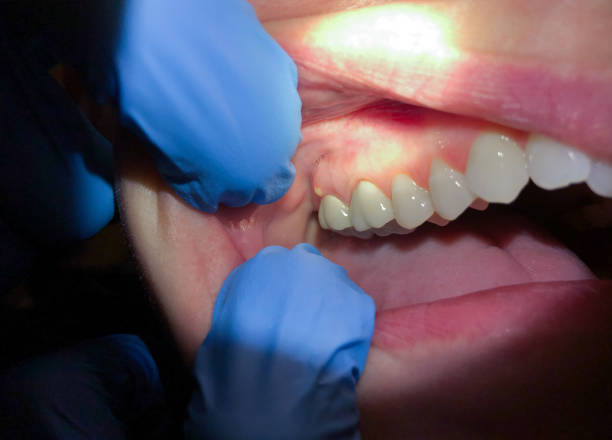 Dentist for Dental Trauma in FL